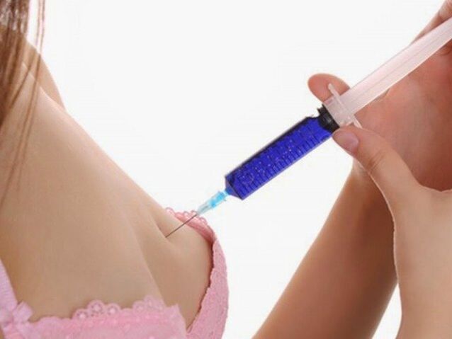 hyaluronzuur injecties voor borstvergroting